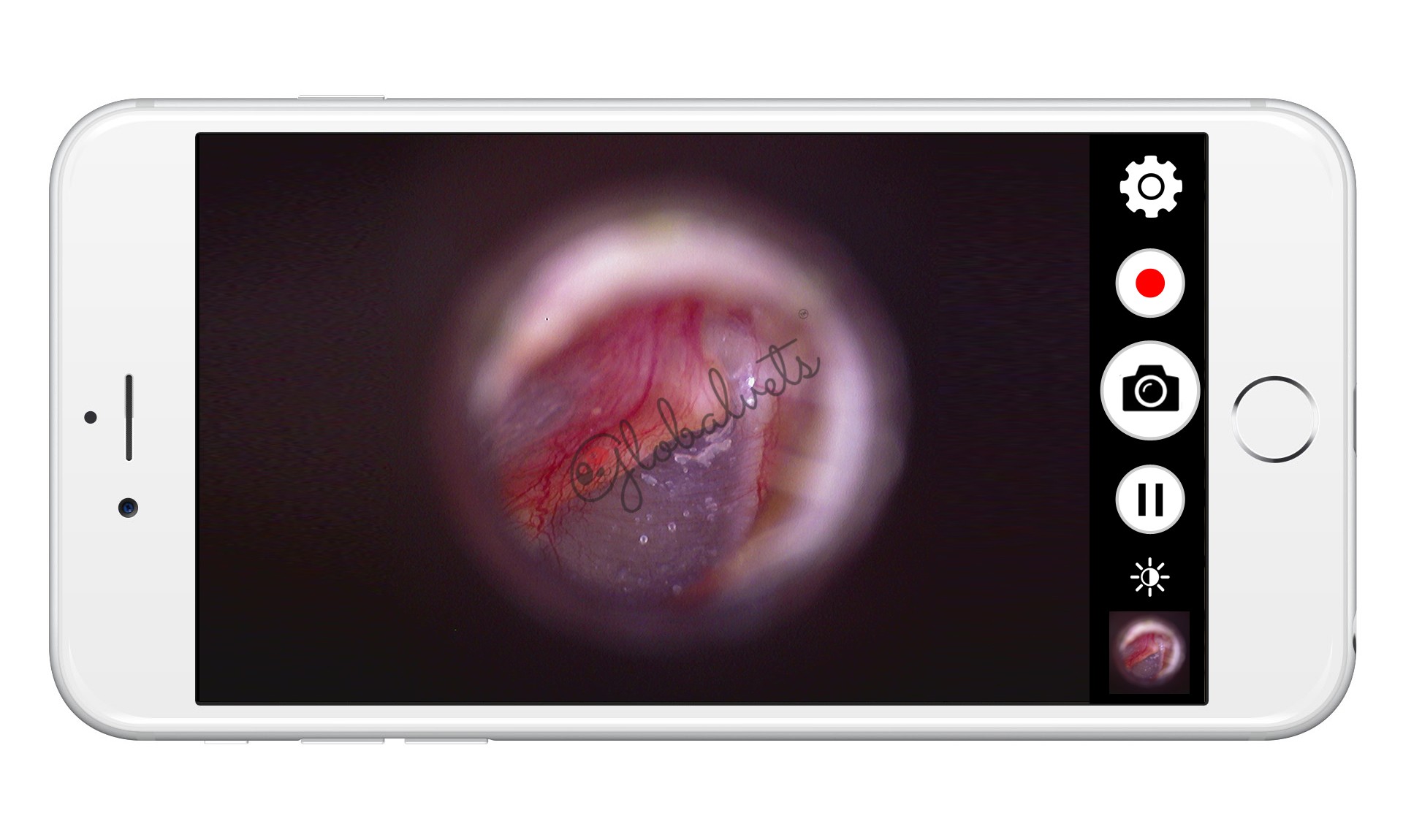 DE571 Wireless HD Veterinary Video Otoscope for Veterinarians and Veterinary Technicians