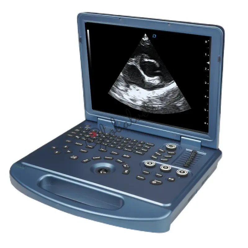 Portable Color Doppler Ultrasound Pet Ultrasound Scanner for Dogs and Cats