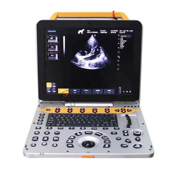 P50-VET Spectral Doppler Imaging Speckle Reduce Imaging Ultrasonic System