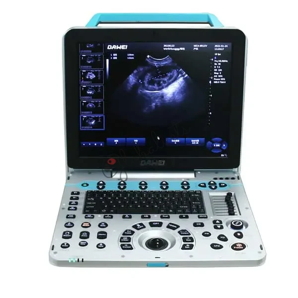 Veterinary Ultrasound System Portable Ultrasound Machine for Pets